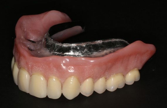 Partial Dentures Procedure Syracuse IN 46567